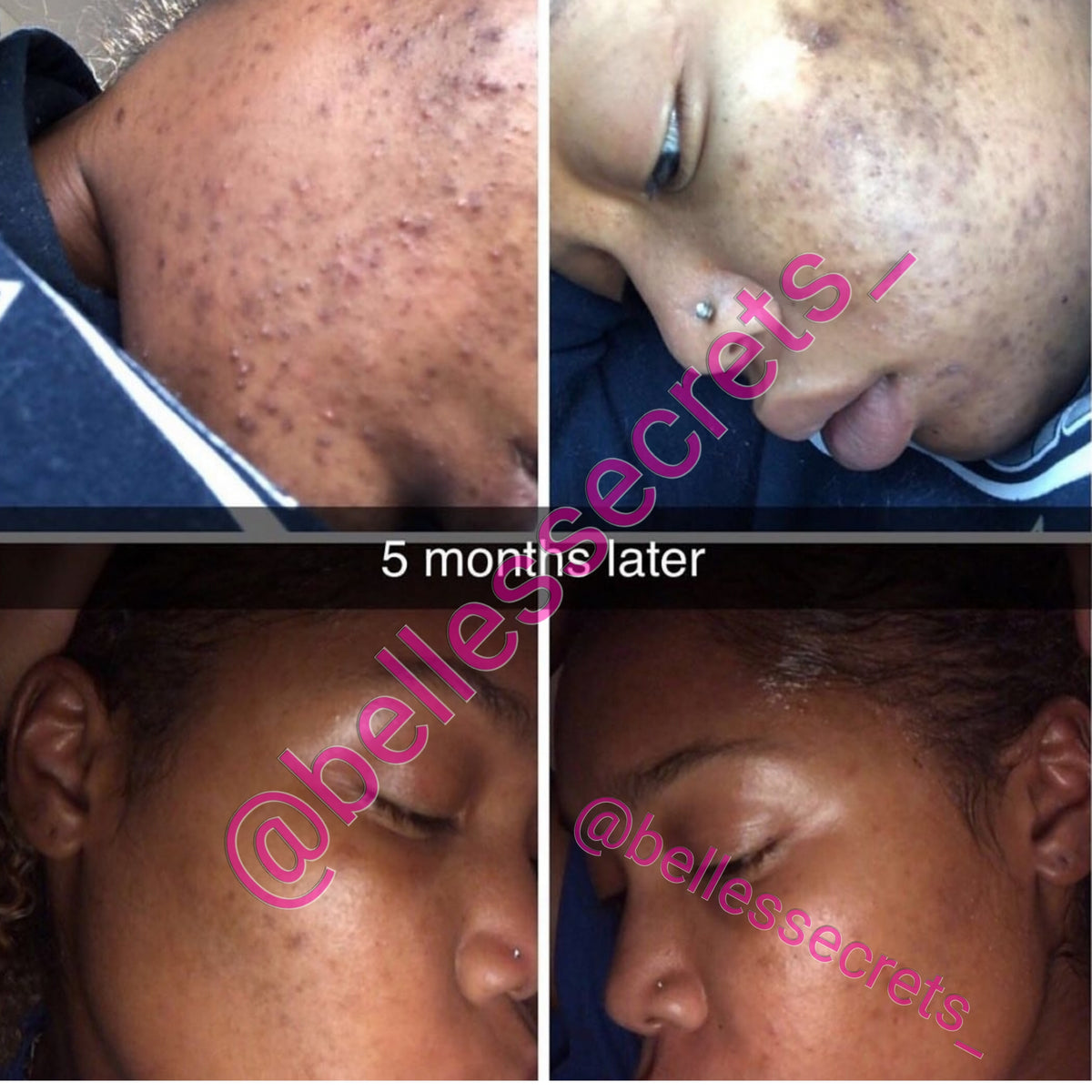 Brightening Moisturizer