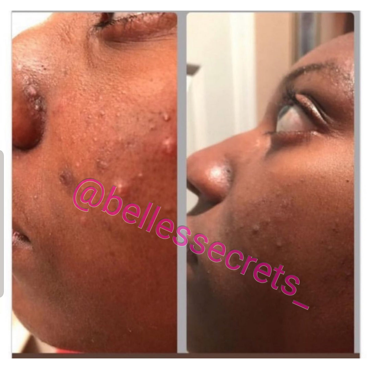 Brightening Facial Wash