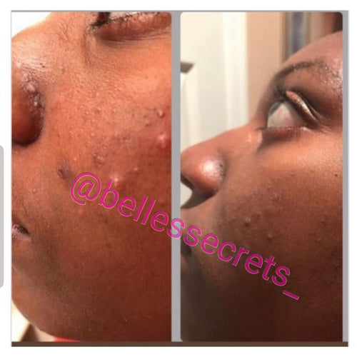 Brightening Facial Wash